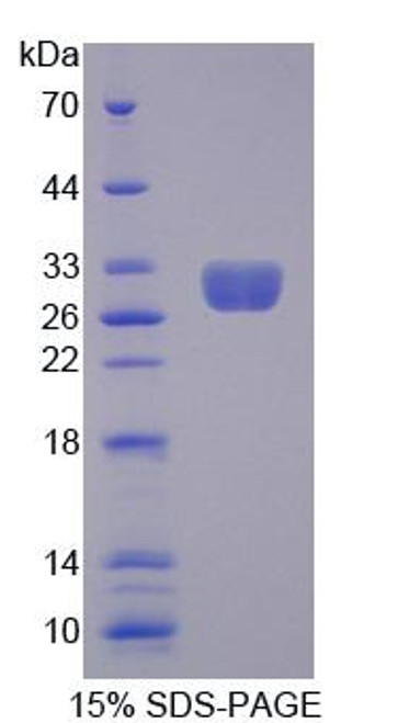 Human Recombinant Methyl CpG Binding Protein 2 (MECP2)