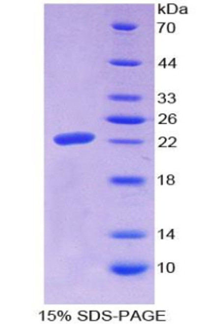 Human Recombinant Microfibrillar Associated Protein 2 (MFAP2)