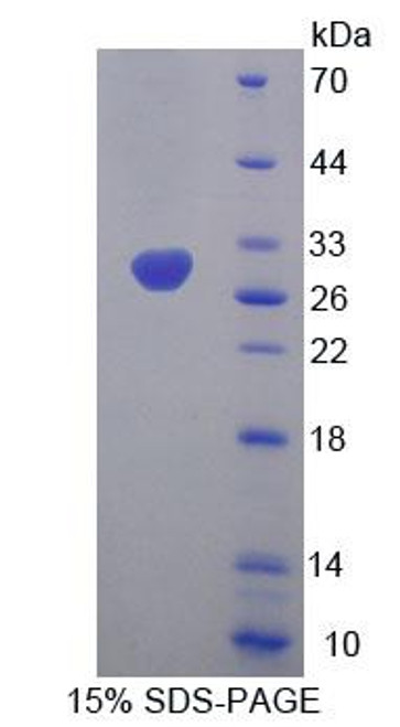 Human Recombinant Mitofusin 1 (MFN1)