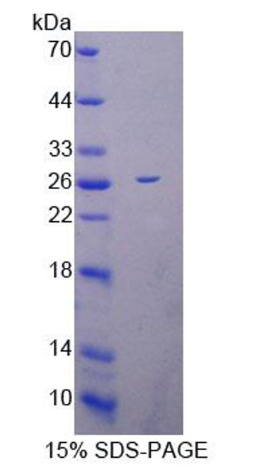 Mouse Recombinant Mitochondrial Ribosomal Protein L1 (MRPL1)