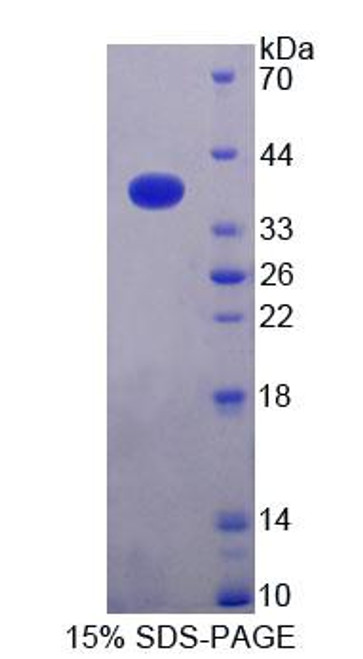 Human Recombinant N-Ethylmaleimide Sensitive Factor Attachment Protein Alpha (NAPa)