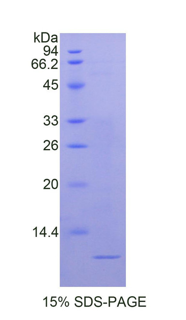 Human Recombinant Nucleophosmin (NPM) Human Recombinant Nucleophosmin (NPM)