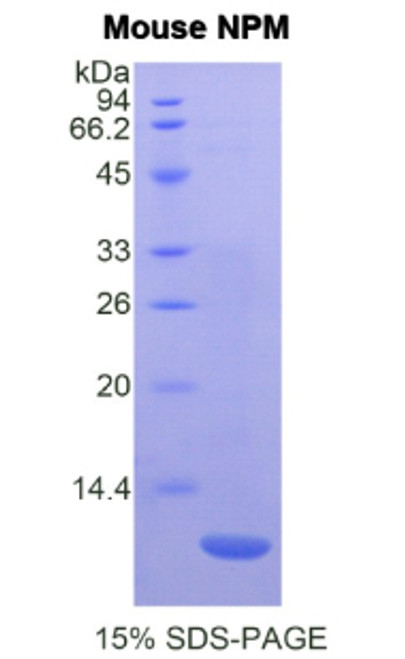 Mouse Recombinant Nucleophosmin (NPM) Mouse Recombinant Nucleophosmin (NPM)