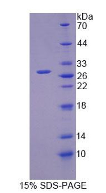 Mouse Recombinant Oligophrenin 1 (OPHN1)