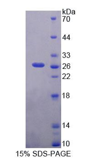 Human Recombinant Pericentriolar Material 1 (PCM1)