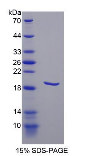 Human Recombinant Podoplanin (PDPN)