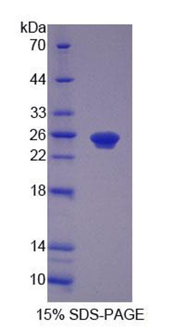 Human Recombinant Peroxisomal Biogenesis Factor 1 (PEX1)