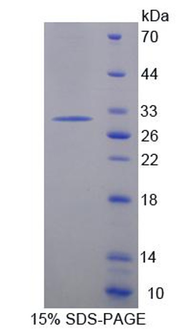 Mouse Recombinant Pituitary Tumor Transforming 1 (PTTG1)