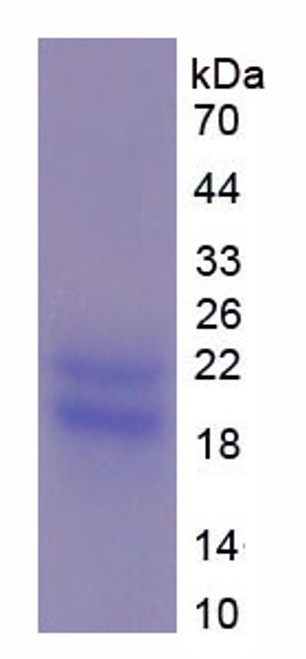 Human Recombinant Peripheral Myelin Protein 22 (PMP22)