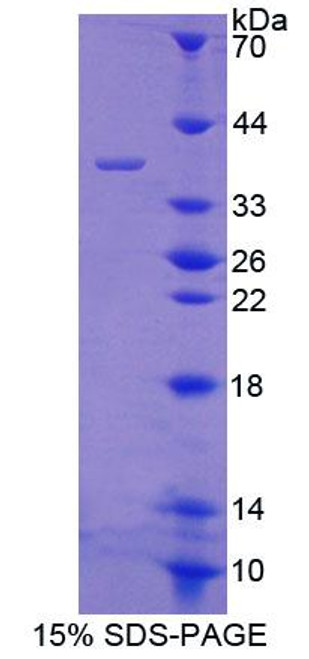 Human Recombinant Radixin (RDX)