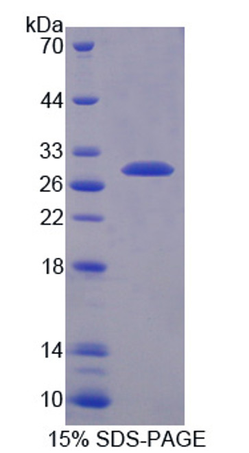 Mouse Recombinant Transmembrane Protease, Serine 2 (TMPRSS2)