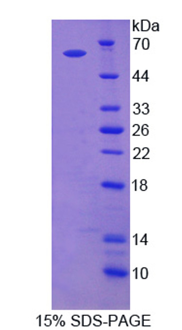 Human Recombinant Adenylyl Cyclase Associated Protein 2 (CAP2)