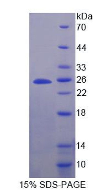 Human Recombinant Secretogranin V (SCG5)