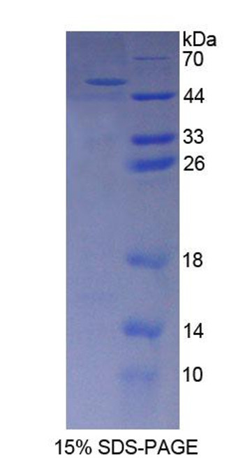 Mouse Recombinant Aminoadipate Semialdehyde Synthase (AASS)