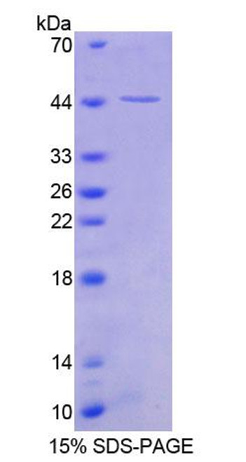 Human Recombinant Snurportin 1 (SNUPN1)