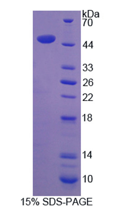 Human Recombinant Sclerostin (SOST)