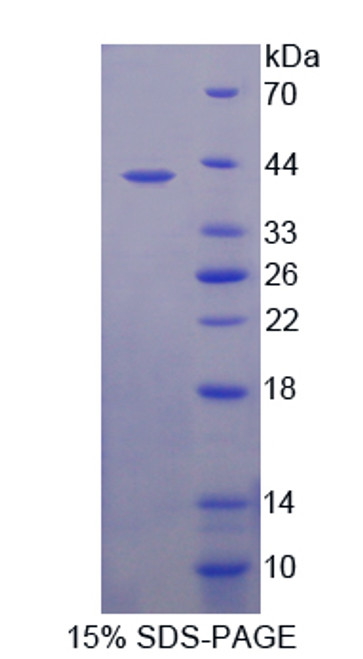 Human Recombinant Serotonin Transporter (SERT)