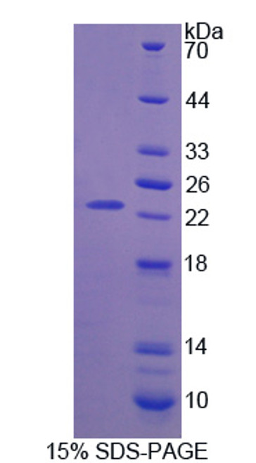 Human Recombinant Fibroblast Growth Factor 11 (FGF11)