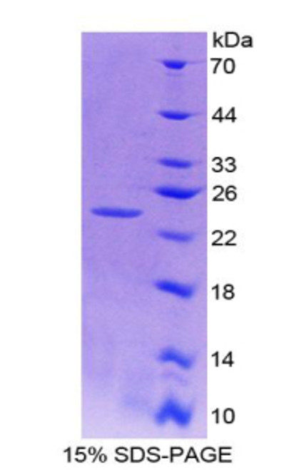 Rat Recombinant Fibroblast Growth Factor 21 (FGF21)