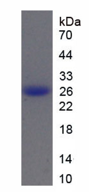 Mouse Recombinant Cathepsin B (CTSB)