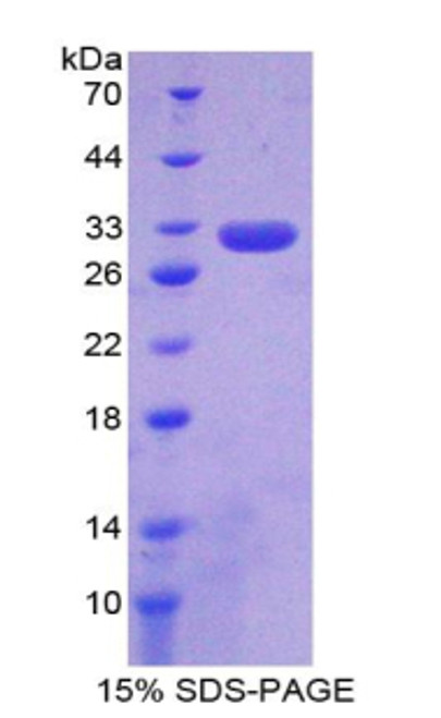 Human Recombinant Complement Component 6 (C6)