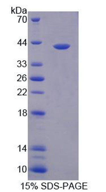 Human Recombinant Poly ADP Ribose Polymerase 4 (PARP4)