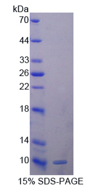 Human Recombinant Glutathione Peroxidase 3, Plasma (GPX3)