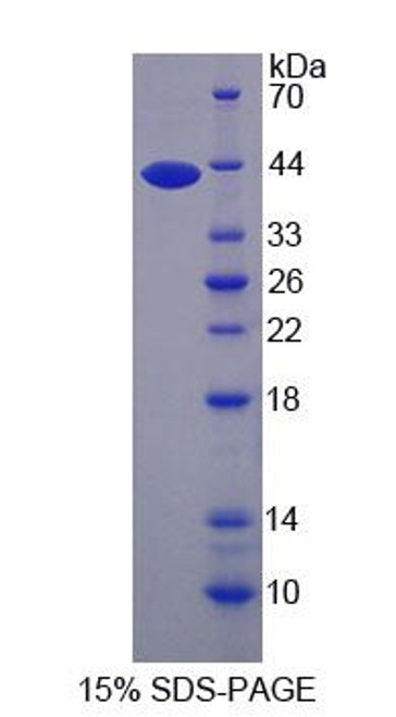 Human Recombinant Asparaginyl tRNA Synthetase (NARS)