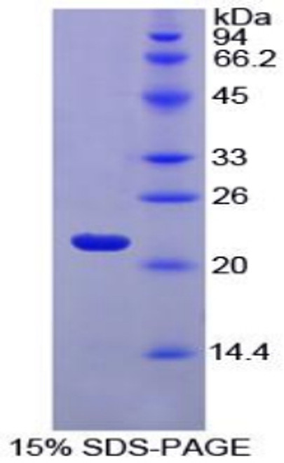 Horse Recombinant Ferritin, Light Polypeptide (FTL)