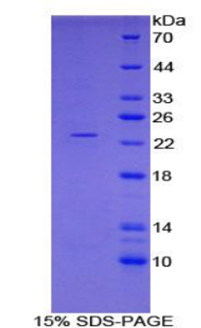 Pig Recombinant Ferritin, Heavy Polypeptide (FTH)