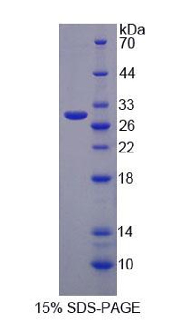 Human Recombinant Membrane Protein, Palmitoylated 3 (MPP3)