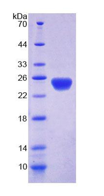 Human Recombinant Discs, Large Homolog 5 (DLG5)