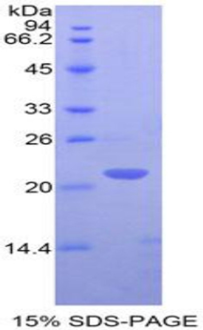 Human Recombinant T-Cell Surface Glycoprotein CD3 Epsilon (CD3e)