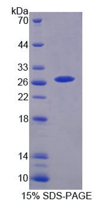 Human Recombinant Cholinergic Receptor, Nicotinic, Alpha 3 (CHRNa3)