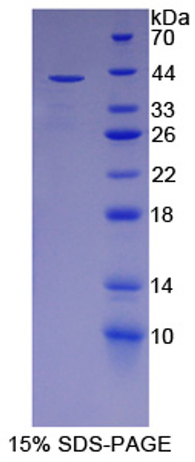 Human Recombinant Paraoxonase 2 (PoN2)