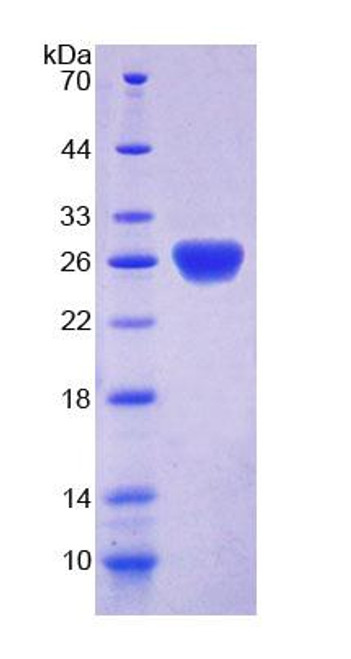 Mouse Recombinant Sjogren Syndrome Antigen A1 (SSA1)