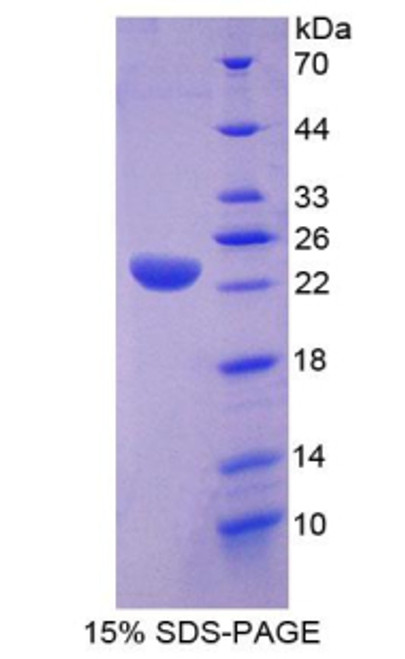 Mouse Recombinant Lipase A, Lysosomal Acid (LIPA)