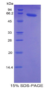 Human Recombinant Troponin C Type 2, Fast (TNNC2)