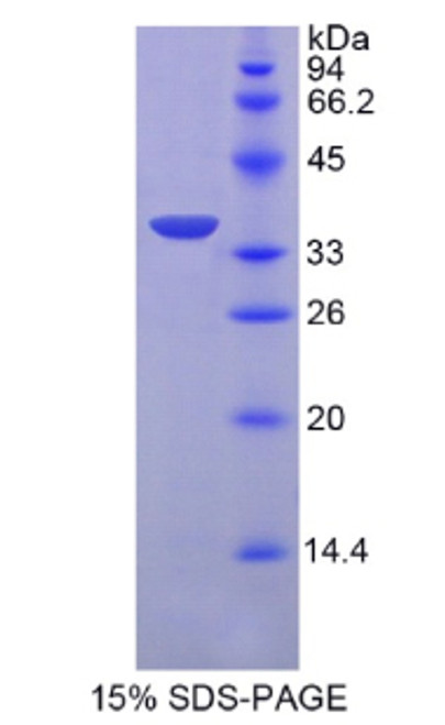 Human Recombinant Troponin T Type 2, Cardiac (TNNT2)