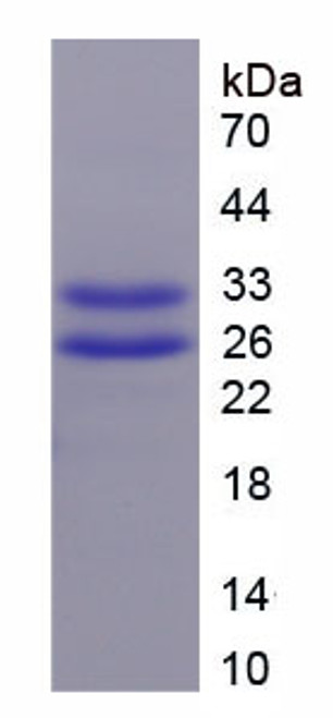 Pig Recombinant Troponin T Type 2, Cardiac (TNNT2)