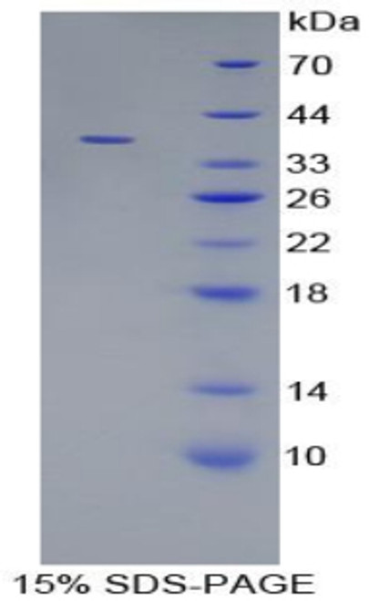 Rat Recombinant Troponin T Type 2, Cardiac (TNNT2)