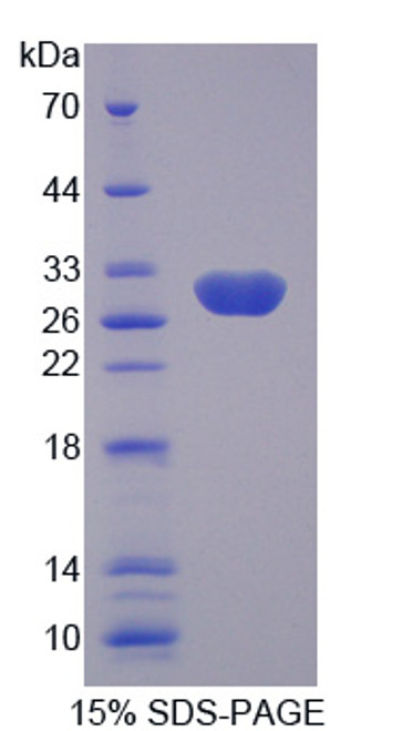 Human Recombinant Amiloride Sensitive Sodium Channel Subunit Gamma (SCNN1g)