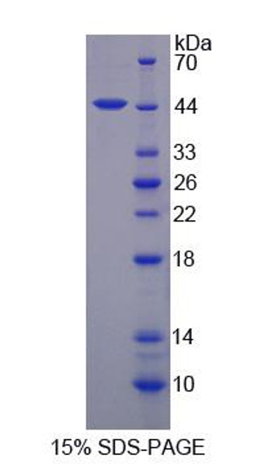 Mouse Recombinant Amiloride Sensitive Sodium Channel Subunit Alpha (SCNN1a)