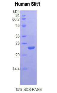 Human Recombinant Slit Homolog 1 (Slit1)