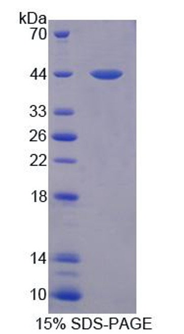 Human Recombinant Kruppel Like Factor 15 (KLF15)