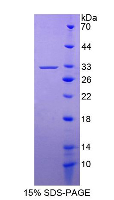 Human Recombinant Kallikrein 13 (KLK13)