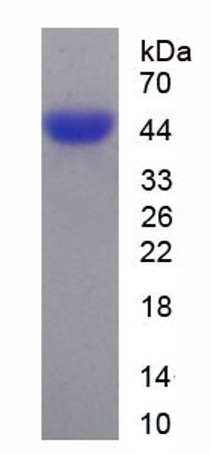 Human Recombinant Dickkopf Related Protein 3 (DKK3)