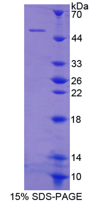 Mouse Recombinant Myosin Light Chain 3, Alkali, Ventricular, Slow Skeletal (MYL3)