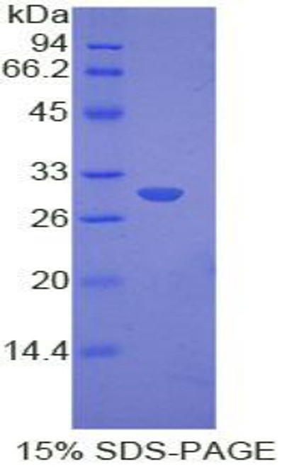 Mouse Recombinant Myosin IE (MYO1E)