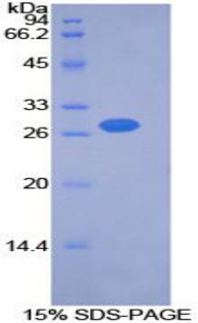 Mouse Recombinant Pyruvate Dehydrogenase Kinase Isozyme 2 (PDK2)